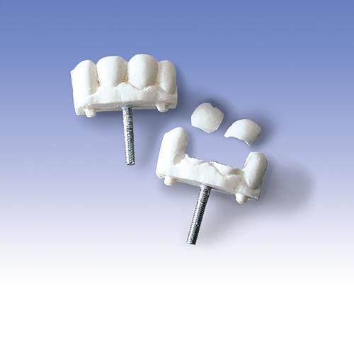 Denti anteriori, set comprendente tre unità, 1005397 [W30510], Gestione delle vie aeree negli adulti