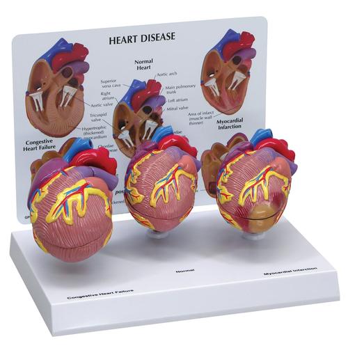 Set mini da 3 modelli di cuore, 1019530 [W33365], Modelli di Cuore e Apparato Circolatorio