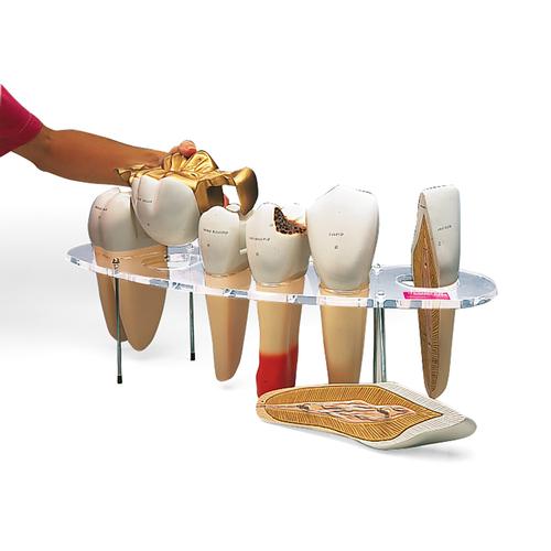 Modello di protesi dentaria, ingrandito 10 volte, in 7 parti - Inglese, 1005540 [W42517], Modelli Dentali