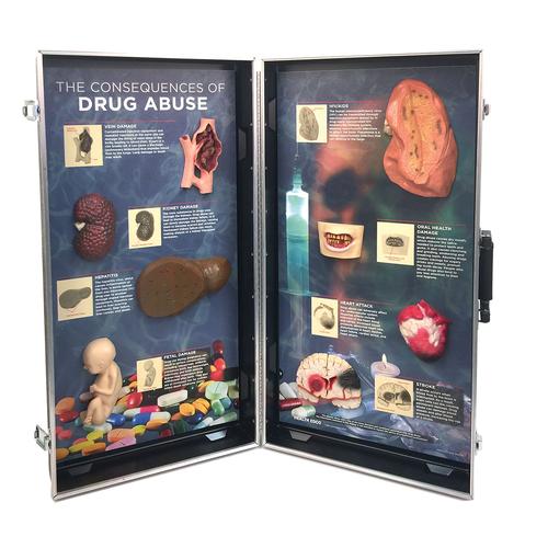 "Le conseguenze dell'abuso di sostanze stupefacenti", presentazione 3D, 1005583 [W43054], Educazione sessuale e sulla tossicodipendenza