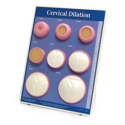 Cervical Dilation Easel Display, 1012488 [W43093], Educazione prenatale