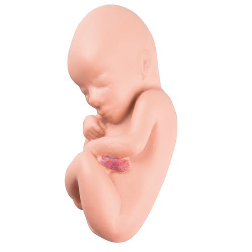 Ricambio feto per L10/4, 1018629 [XL002], Ricambi