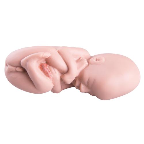 Ricambio feto per L10/5, 1018634 [XL003], Ricambi