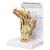 Modello di mano con artrite reumatoide, 1019521, Modelli di scheletro della mano e del braccio (Small)