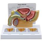 Pelvi maschili con prostata in 3D, 1019563, Modelli di Pelvi e Organi genitali