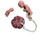 Manichino di feto abortito
, 1024667, Simulatori medici
