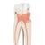 Dente molare superiore a tre radici, in 3 parti - 3B Smart Anatomy, 1017580 [D10/5], Modelli Dentali (Small)