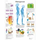  Osteoporose, 4006570 [VR0121UU], Strumenti didattici su artrite e osteoporosi
