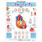 Herzinfarkt, 4006597 [VR0342UU], Strumenti didattici cardiaci e di cardiofitness