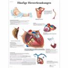 Häufige Herzerkrankungen, 1001362 [VR0343L], Strumenti didattici cardiaci e di cardiofitness