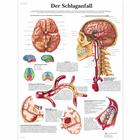 Deer Schlaganfall, 4006630 [VR0627UU], sistema Cardiovascolare