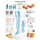 Varicose Veins Chart, 1001534 [VR1367L], sistema Cardiovascolare