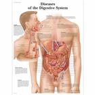 Diseases of the Digestive System Chart, 1001548 [VR1431L], Il sistema digestivo
