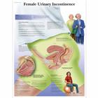 Female Urinary Incontinence, 1001570 [VR1542L], Ginecologia
