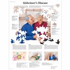 Alzheimer's Disease, 1001592 [VR1628L], Cervello e del sistema nervoso