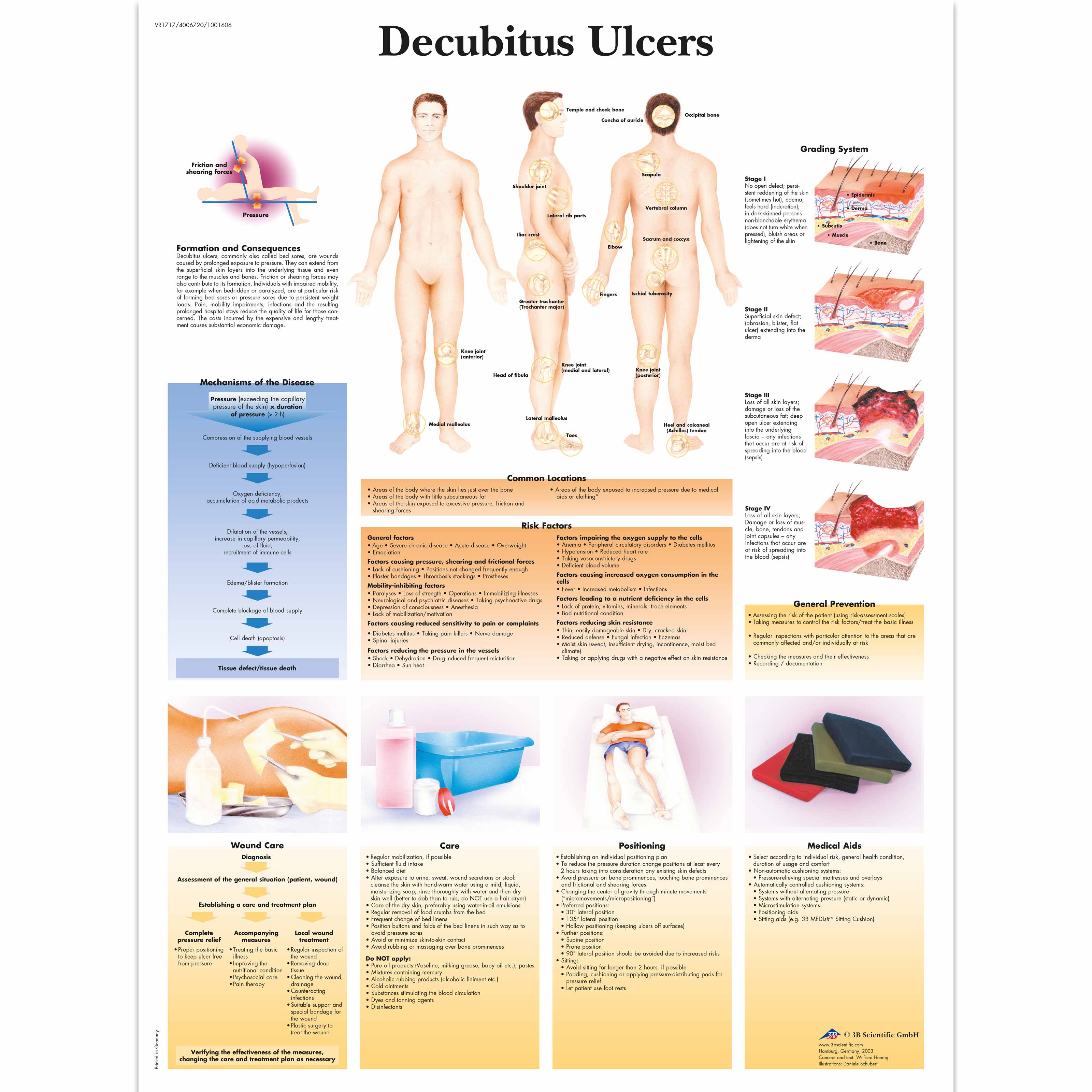 Decubitus Ulcer or Bed Sores: Causes & Treatments