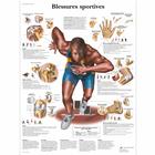 Blessures sportives, 4006746 [VR2188UU], Muscolo
