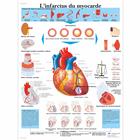 L'infarctus du myocarde, 1001692 [VR2342L], Strumenti didattici cardiaci e di cardiofitness