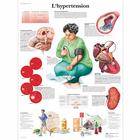 L'hypertension, 1001699 [VR2361L], sistema Cardiovascolare