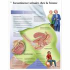 Incontinence urinaire chez la femme, 4006785 [VR2542UU], Ginecologia
