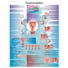 Contraception, 4006790 [VR2591UU], Gravidanza e Parto
