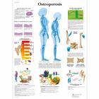 Osteoporosis, 4006816 [VR3121UU], Strumenti didattici su artrite e osteoporosi