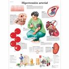 Hipertensión arterial, 4006846 [VR3361UU], sistema Cardiovascolare