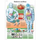 Diabetes Mellitus Chart, 1001885 [VR3441L], Sistema metabolico