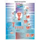 Contraception, 1001909 [VR3591L], Ginecologia
