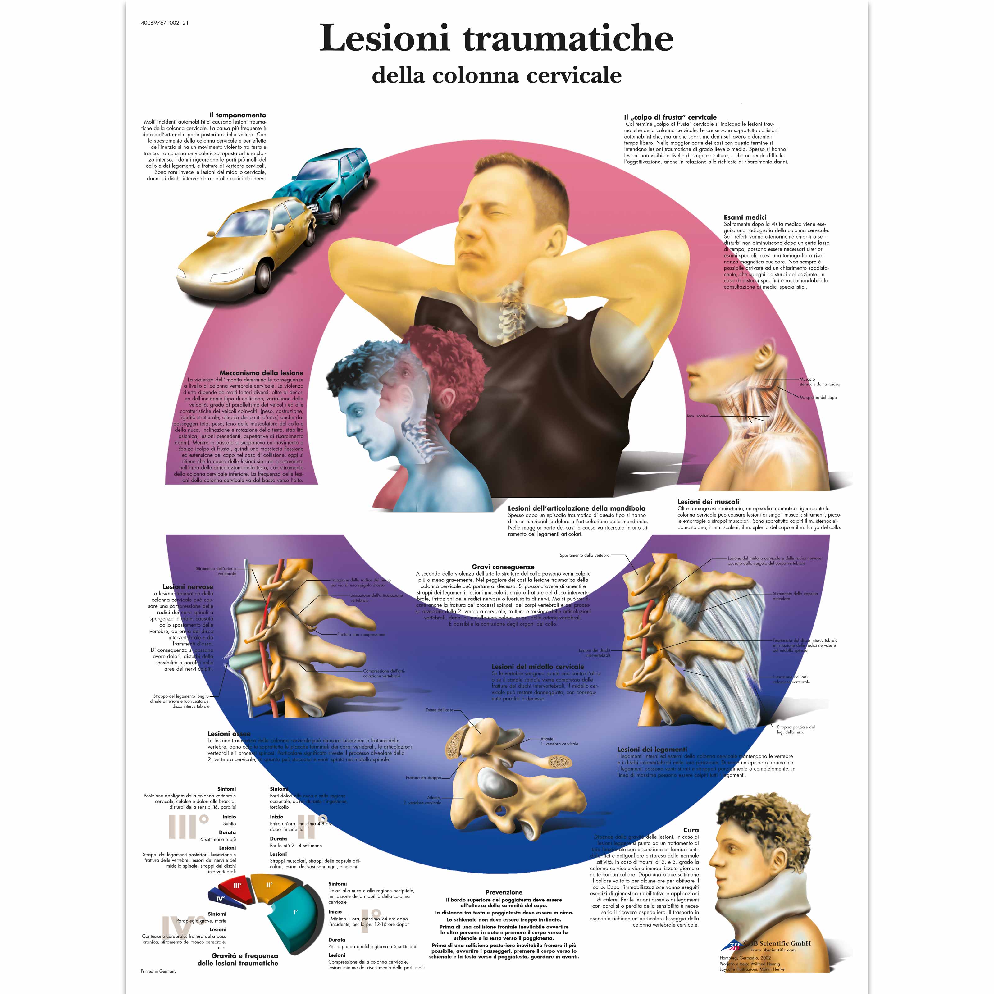 Lesioni traumatiche della colonna cervicale 1002121 VR4761L