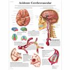 Acidente Cerebrovascular, 4007008 [VR5627UU], sistema Cardiovascolare