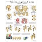 Медицинский плакат "Таз и тазобедренный сустав, анатомия и патология", 1002228 [VR6172L], Sistema Scheletrico