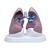 Set di polmoni con patologie, 1018749 [W33371], Modelli di Polmone (Small)