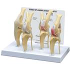 Modello di ginocchio canino con osteoartrite, condizione normale + 3 patologie, 1019577 [W33373], osteologia
