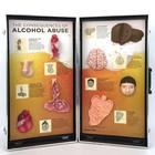 "Le conseguenze dell'abuso di alcol", presentazione 3D, 1005582 [W43053], Educazione sessuale e sulla tossicodipendenza